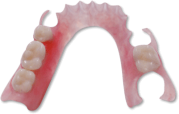 Flexible Partial Dentures